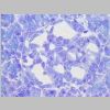 Pancreas SF 25.jpg